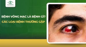 bệnh võng mạc