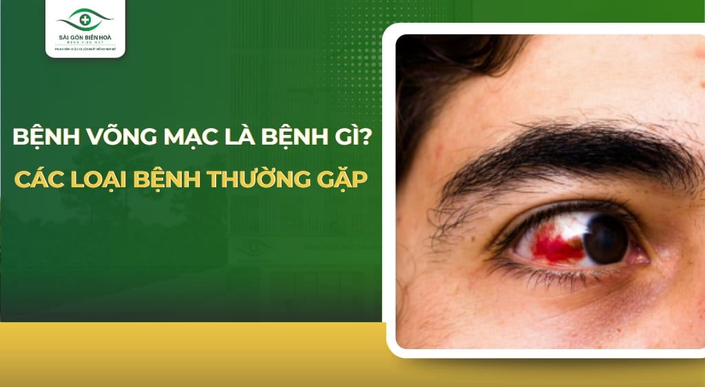 bệnh võng mạc