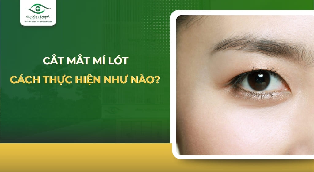 cắt mắt mí lót