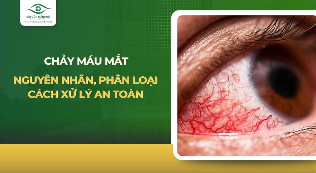 chảy máu mắt