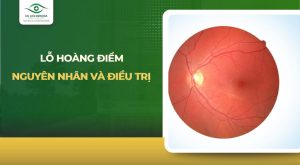 lỗ hoàng điểm