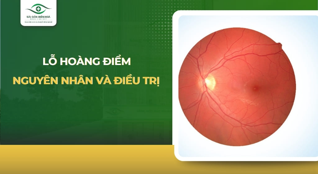 lỗ hoàng điểm
