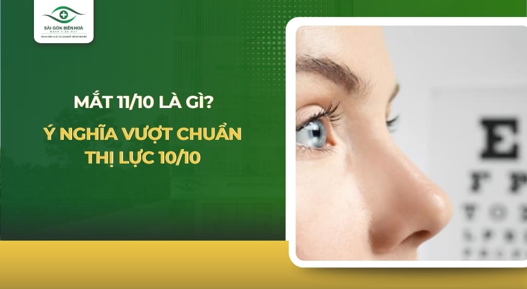 mắt 11/10