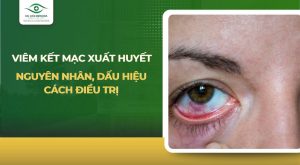 viêm kết mạc xuất huyết