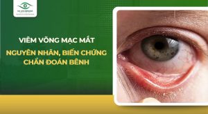 viêm võng mạc