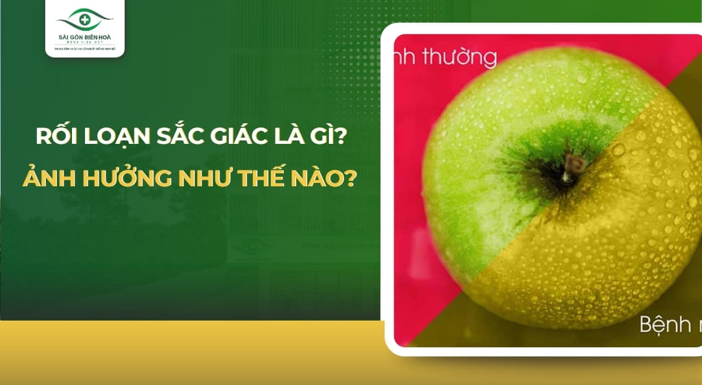 rối loạn sắc giác