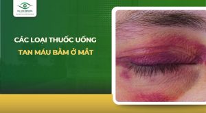 thuốc uống tan máu bầm ở mắt
