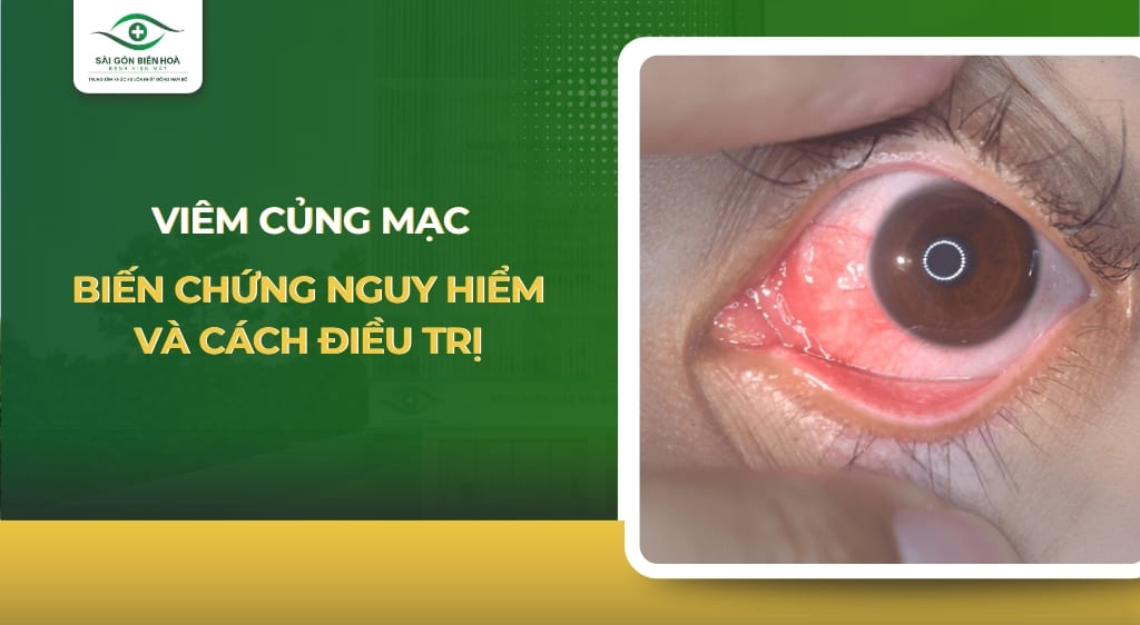 viêm củng mạc