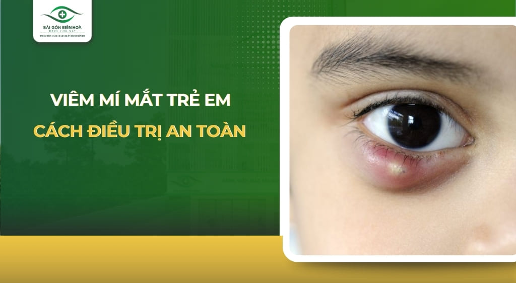 viêm mí mắt trẻ em