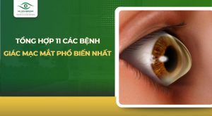 bệnh giác mạc mắt