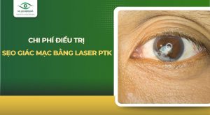 chi phí điều trị sẹo giác mạc bằng laser