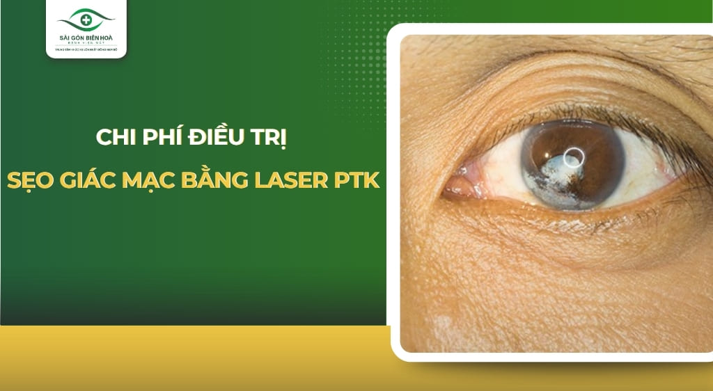 chi phí điều trị sẹo giác mạc bằng laser