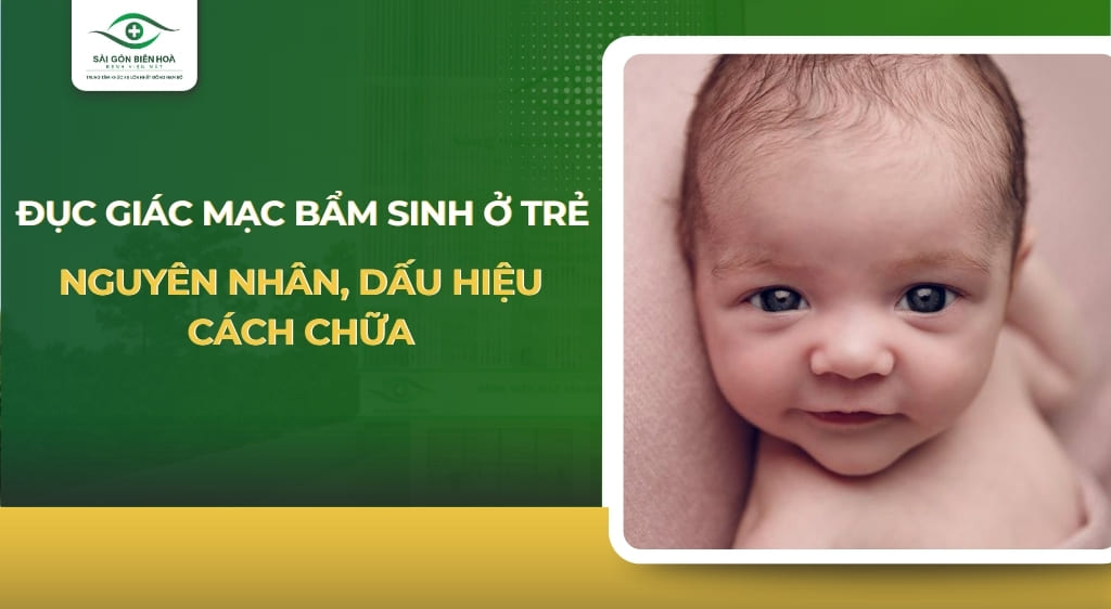 đục giác mạc bẩm sinh