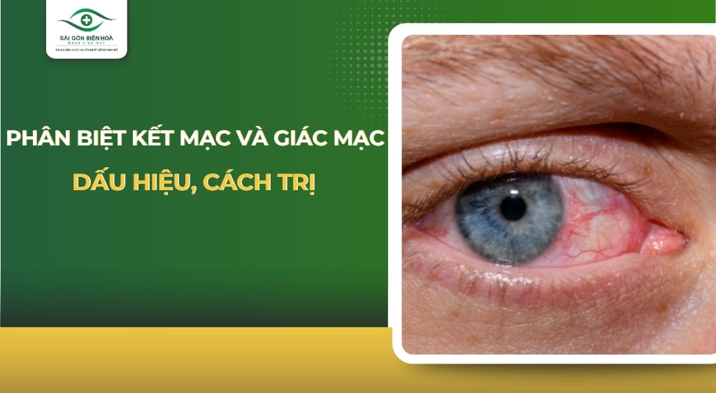 kết mạc và giác mạc