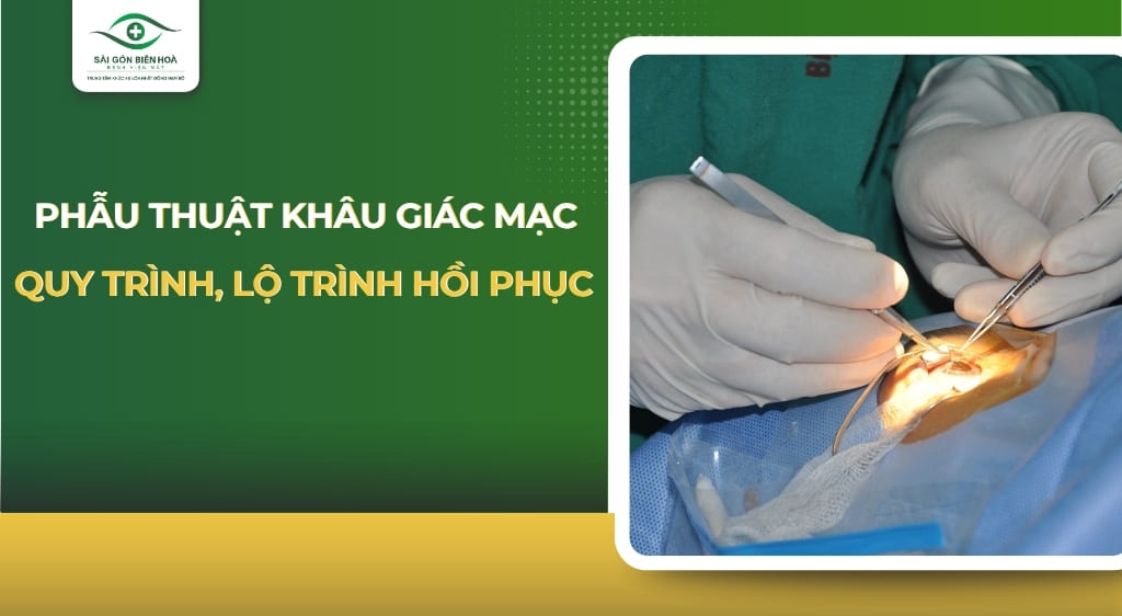 khâu giác mạc