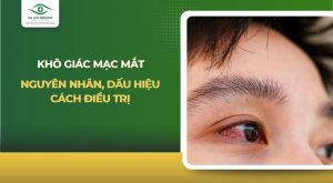 khô giác mạc