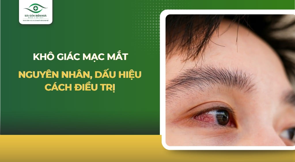 khô giác mạc