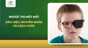 nhược thị một mắt
