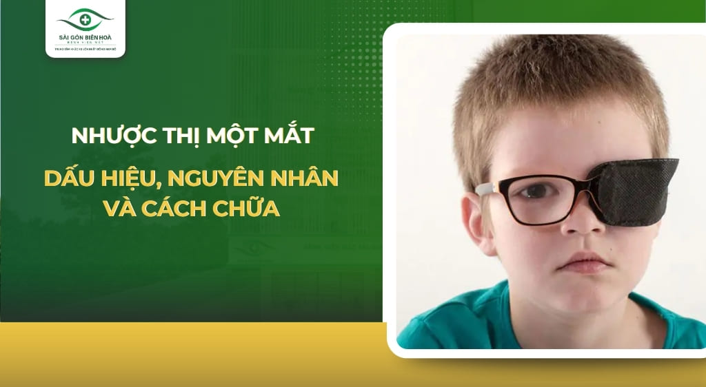 nhược thị một mắt