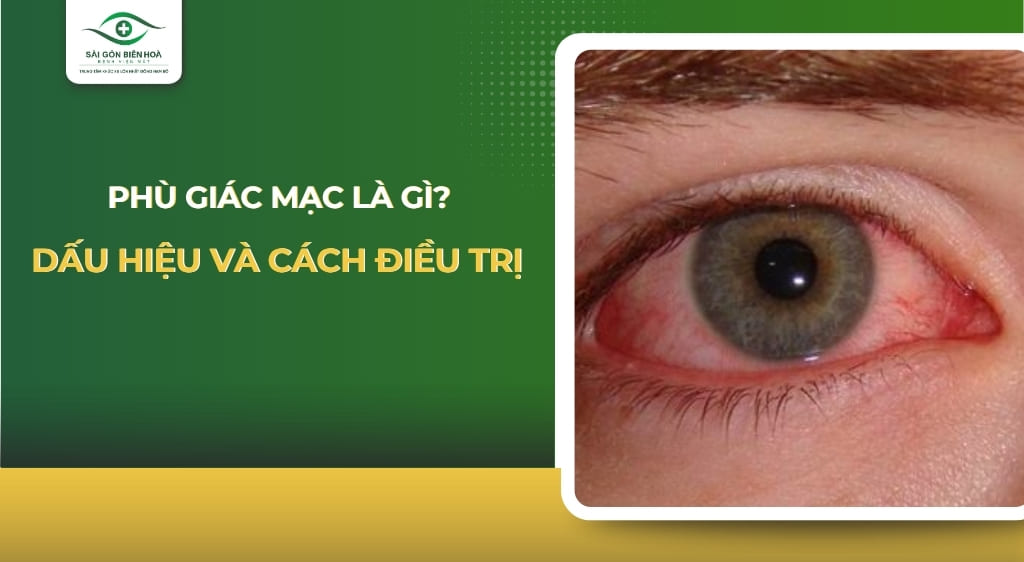 phù giác mạc