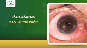 rách giác mạc bao lâu thì khỏi