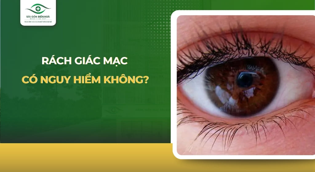 rách giác mạc có nguy hiểm không