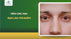 bệnh viêm giác mạc bao lâu khỏi