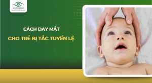 cách day mắt cho trẻ bị tắc tuyến lệ