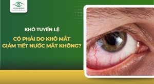 khô tuyến lệ