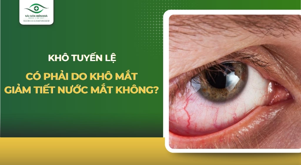 khô tuyến lệ