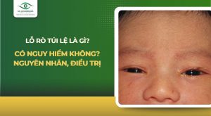 lỗ rò túi lệ