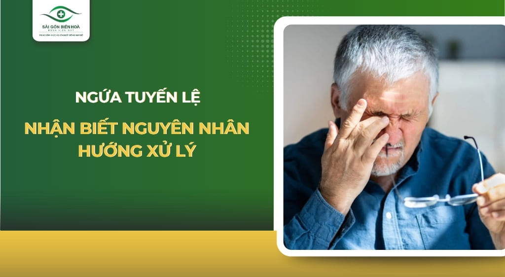 ngứa tuyến lệ