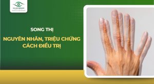 song thị