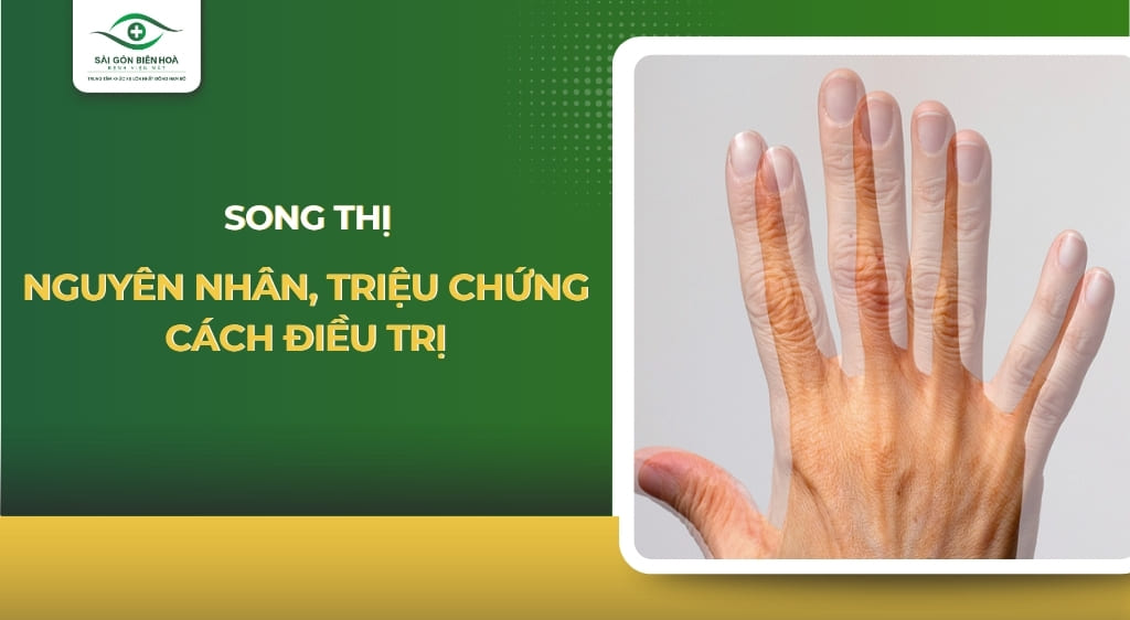 song thị