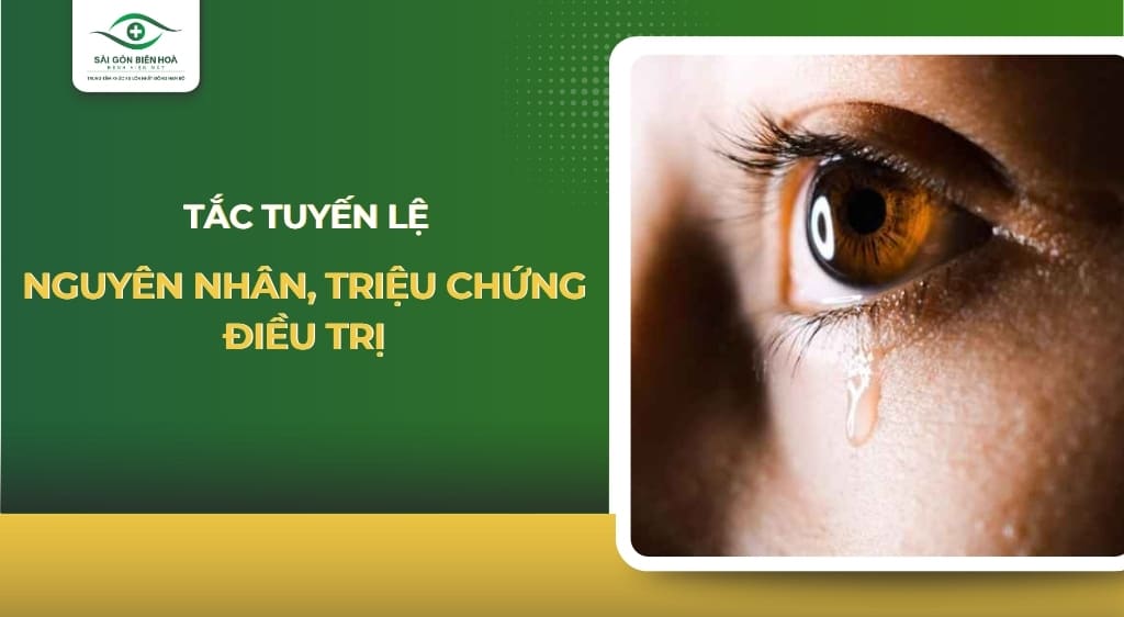 tắc tuyến lệ
