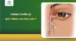 thông tuyến lệ