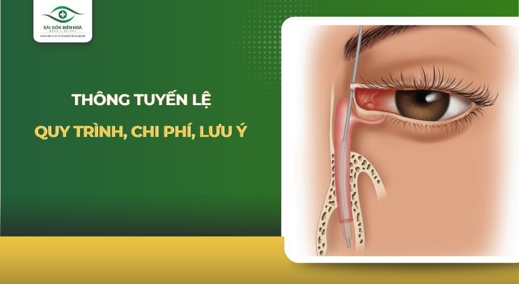 thông tuyến lệ