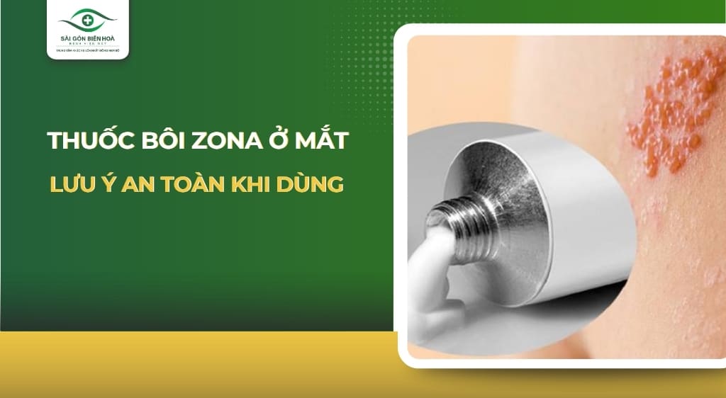 Thuốc bôi zona ở mắt