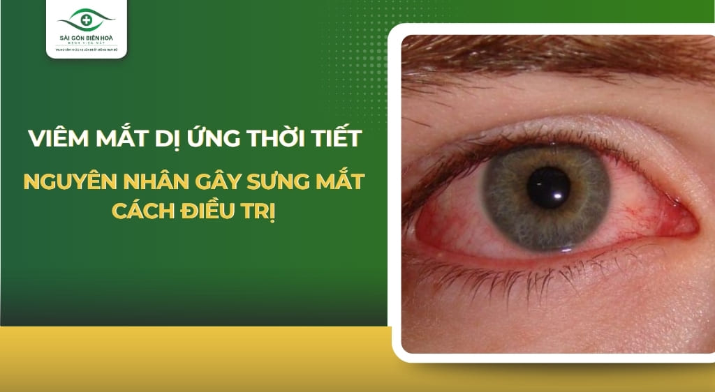 viêm mắt dị ứng thời tiết