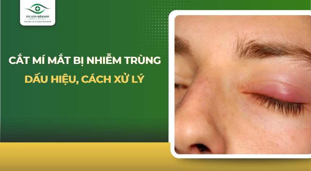Cắt mí mắt bị nhiễm trùng