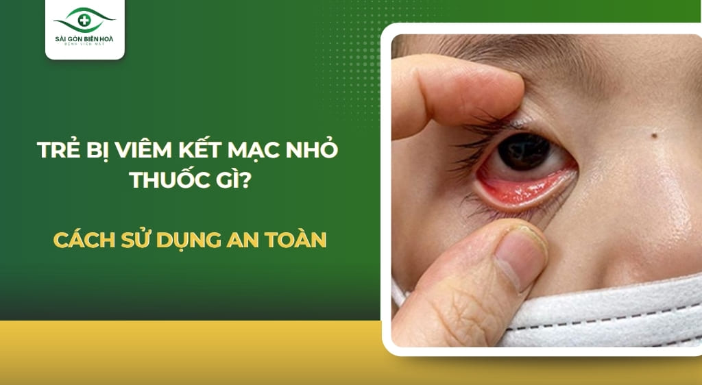 Trẻ bị viêm kết mạc nhỏ thuốc gì