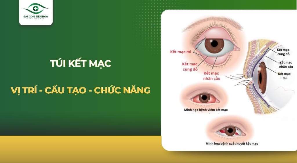 Túi kết mạc