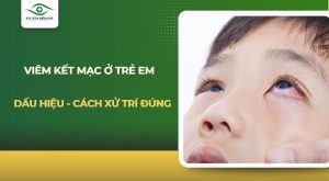 Viêm kết mạc ở trẻ em