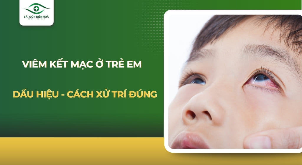 Viêm kết mạc ở trẻ em