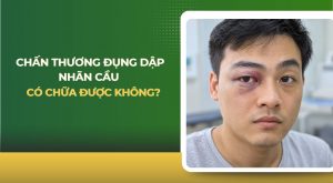 Chấn thương đụng dập nhãn cầu