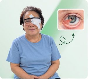 Phẫu thuật mộng thịt