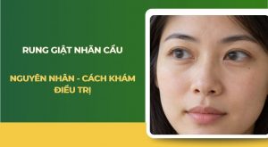 Rung giật nhãn cầu