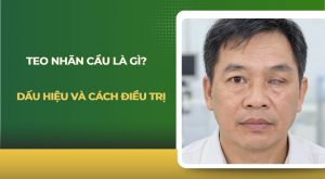 Teo nhãn cầu