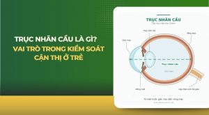 Trục nhãn cầu