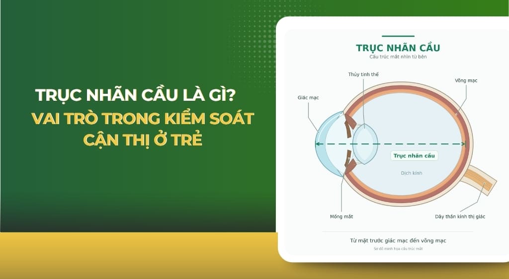Trục nhãn cầu